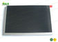 LM220W1- A2MN 22.0 ইঞ্চি মেডিকেল LCD প্রদর্শন সাধারণত 470.4 × 301.1 মিমি সঙ্গে কালো